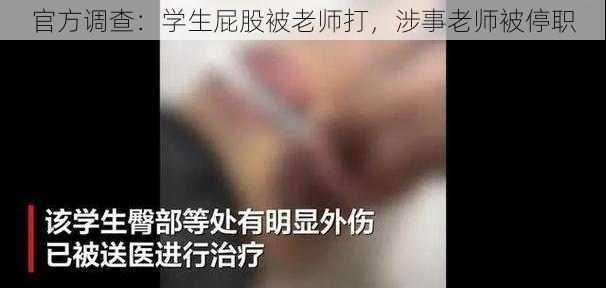 官方调查：学生屁股被老师打，涉事老师被停职